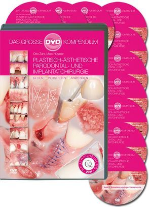 Plastisch-Ästhetische Parodontal- und Implantatchirurgie von Hürzeler,  Marc, Zuhr,  Otto