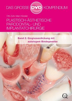 Plastisch-Ästhetische Parodontal- und Implantatchirurgie / Plastisch-Ästhetische Parodontal- und Implantatchirurgie von Hürzeler,  Marc, Zuhr,  Otto