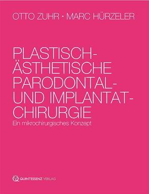 Plastisch-ästhetische Parodontal- und Implantatchirurgie von Hürzeler,  Marc, Zuhr,  Otto