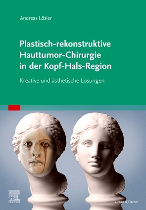 Plastisch-rekonstruktive Hauttumor-Chirurgie in der Kopf-Hals-Region von Lösler,  Andreas