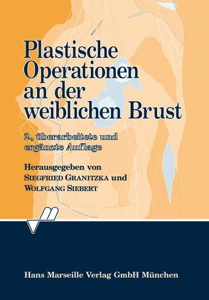 Plastische Operationen an der Weiblichen Brust von Granitzka,  Siegfried, Siebert,  Wolfgang