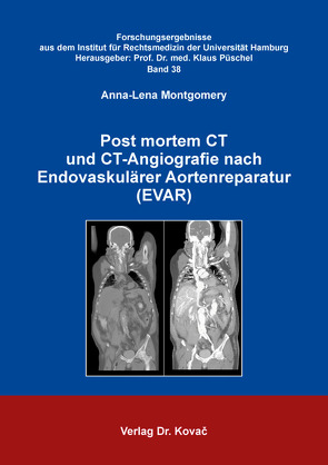 Post mortem CT und CT-Angiografie nach Endovaskulärer Aortenreparatur (EVAR) von Montgomery,  Anna-Lena