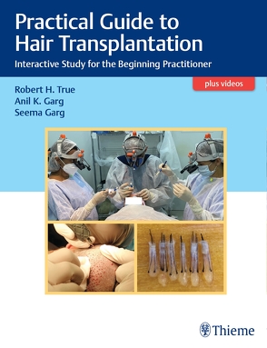 Practical Guide to Hair Transplantation – Interactive Study for the Beginning Practitioner