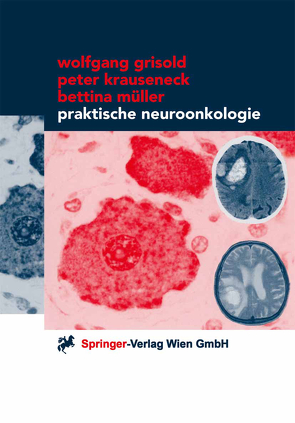Praktische Neuroonkologie von Grisold,  Wolfgang, Krauseneck,  Peter, Müller,  Bettina