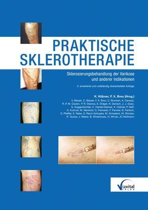 Praktische Sklerotherapie von Breu,  Franz-Xaver, Hübner,  Klaus