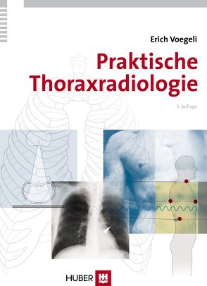 Praktische Thoraxradiologie von Voegeli,  Erich