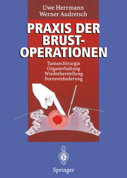 Praxis der Brustoperationen von Audretsch,  Werner, Herrmann,  Uwe