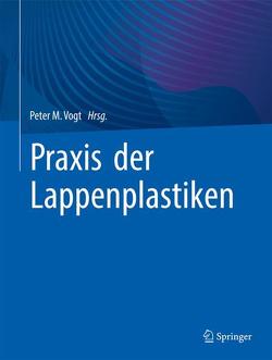 Praxis der Lappenplastiken von Vogt,  Peter M.