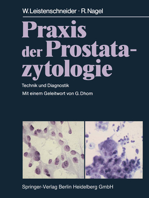 Praxis der Prostatazytologie von Dhom,  G., Leistenschneider,  W., Nagel,  R.