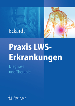 Praxis LWS-Erkrankungen von Eckardt,  Anke