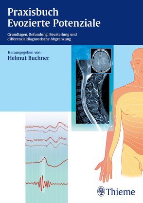 Praxisbuch Evozierte Potenziale von Buchner,  Helmut