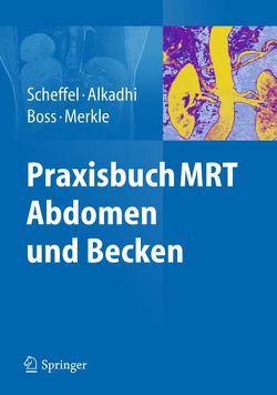 Praxisbuch MRT Abdomen und Becken von Alkadhi,  Hatem, Boss,  Andreas, Merkle,  Elmar, Scheffel,  Hans