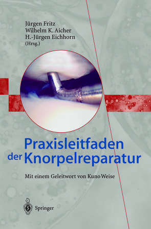Praxisleitfaden der Knorpelreparatur von Aicher,  Wilhelm K., Eichhorn,  H.-Jürgen, Fritz,  Jürgen