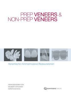 Prep Veneers und Non-Prep Veneers von Schicha,  Kerstin, Witkowski,  Siegbert