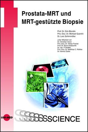 Prostata-MRT und MRT-gestützte Biopsie von Blondin,  Dirk, Quentin,  Michael, Schimmöller,  Lars