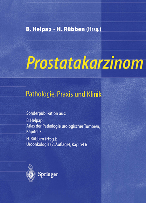 Prostatakarzinom — Pathologie, Praxis und Klinik von Altwein,  J.E., Helpap,  B., Helpap,  Burkhard, Otto,  T., Rübben,  H., Rübben,  Herbert, Wirth,  M.