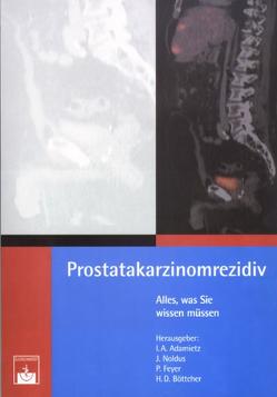 Prostatakarzinomrezidiv von Adamietz,  I A, Böttcher,  H D, Feyer,  P, Noldus,  J