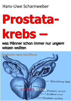 Prostatakrebs von Scharnweber,  Hans-Uwe