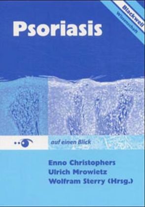 Psoriasis auf einen Blick 3894125470 von Christophers,  Enno, Mrowietz,  Ulrich, Sterry,  Wolfram