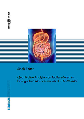 Quantitative Analytik von Gallensäuren in biologischen Matrices mittels LC-ESI-MS/MS von Reiter,  Sinah