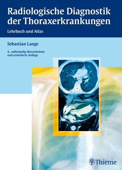 Radiologische Diagnostik der Thoraxerkrankungen von Lange,  Sebastian, Montag,  Michael