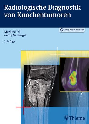 Radiologische Diagnostik von Knochentumoren von Herget,  Georg W., Uhl,  Markus