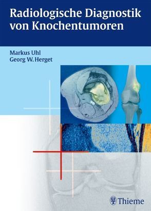 Radiologische Diagnostik von Knochentumoren von Herget,  Georg W., Rottenburger,  Christof, Uhl,  Markus