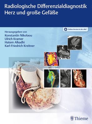 Radiologische Differenzialdiagnostik Herz und große Gefäße von Alkadhi,  Hatem, Krämer,  Ulrich, Kreitner,  Karl-Friedrich, Nikolaou,  Konstantin