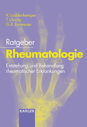 Ratgeber Rheumatologie von Burmester,  G.R., Loddenkemper,  K., Ulrichs,  T.