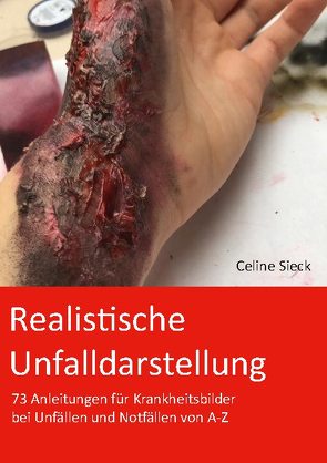 Realistische Unfalldarstellung von Sieck,  Celine