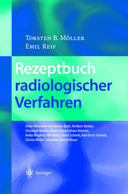 Rezeptbuch radiologischer Verfahren von Bach,  M., Becker,  H., Buntru,  C., Hilpert,  B., Kuhnen,  K., Möller,  Torsten B., Reif,  Emil, Ringling,  H., Roed,  N., Schmitt,  A., Schmitt,  K.-E., Weller-Schweizer,  C., Weyer,  B.