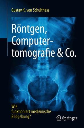 Röntgen, Computertomografie & Co. von von Schulthess,  Gustav K.