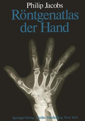 Röntgenatlas der Hand von Jacobs,  P., Kaiser,  G., Kaiser,  M.