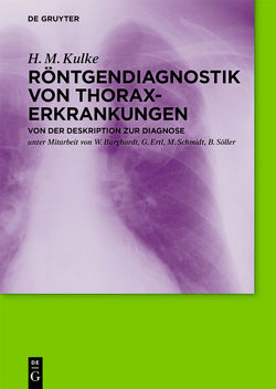 Röntgendiagnostik von Thoraxerkrankungen von Kulke,  H. M.