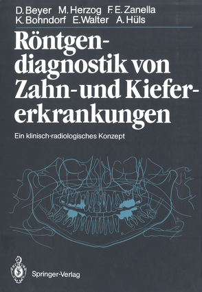 Röntgendiagnostik von Zahn- und Kiefererkrankungen von Beyer,  Dieter, Bohndorf,  Klaus, Friedmann,  G., Herzog,  Michael, Hüls,  Alfons, Pape,  H.-D., Walter,  Eberhard, Zanella,  Friedhelm