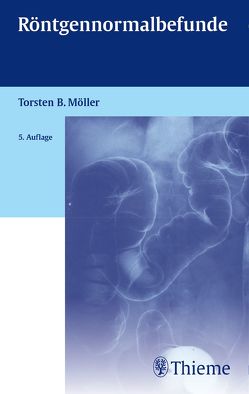 Röntgennormalbefunde von Möller,  Torsten Bert