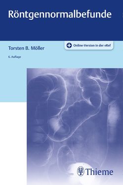 Röntgennormalbefunde von Möller,  Torsten Bert
