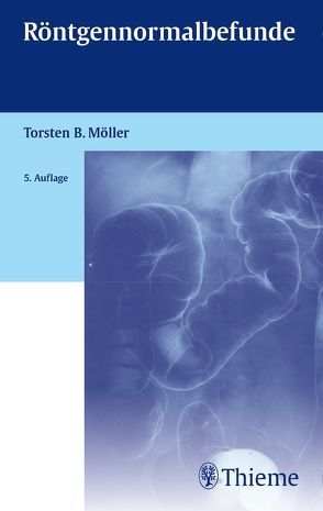 Röntgennormalbefunde von Möller,  Torsten Bert