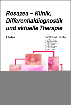Rosazea – Klinik, Differentialdiagnostik und aktuelle Therapie von Schaller,  Martin