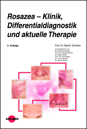 Rosazea – Klinik, Differentialdiagnostik und aktuelle Therapie von Schaller,  Martin