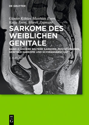 Sarkome des weiblichen Genitale / Andere seltene Sarkome, Mischtumoren, genitale Sarkome und Schwangerschaft von Evert,  Katja, Evert,  Matthias, Köhler,  Günter, Zygmunt,  Marek