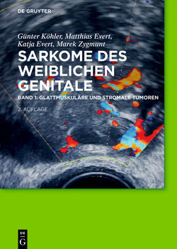 Sarkome des weiblichen Genitale / Glattmuskuläre und stromale Tumoren von Evert,  Katja, Evert,  Matthias, Köhler,  Günter, Zygmunt,  Marek