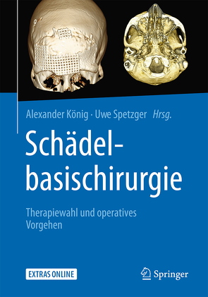 Schädelbasischirurgie von Koenig,  Alexander, Spetzger,  Uwe