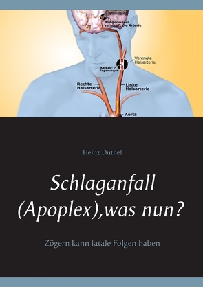 Schlaganfall (Apoplex), was nun? von Duthel,  Heinz