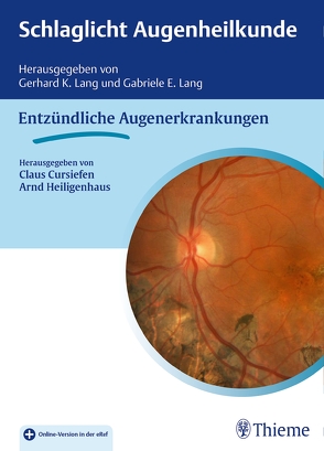 Schlaglicht Augenheilkunde: Entzündliche Erkrankungen von Cursiefen,  Claus, Heiligenhaus,  Arnd, Lang,  Gabriele E., Lang,  Gerhard K.