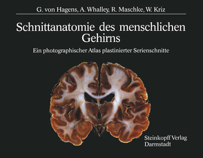 Schnittanatomie des menschlichen Gehirns von Hagens,  G.v., Kriz,  W., Maschke,  R., Whalley,  A.