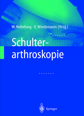 Schulterarthroskopie von Nebelung,  Wolfgang, Wiedemann,  Ernst