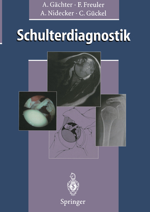 Schulterdiagnostik von Freuler,  Franz, Gächter,  Andre, Gückel,  Claudius, Nidecker,  Andreas