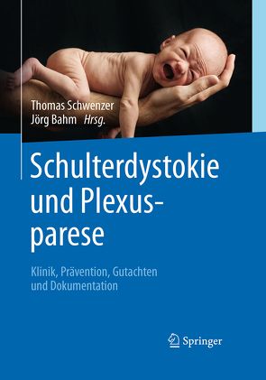 Schulterdystokie und Plexusparese von Bahm,  Jörg, Schwenzer,  Thomas