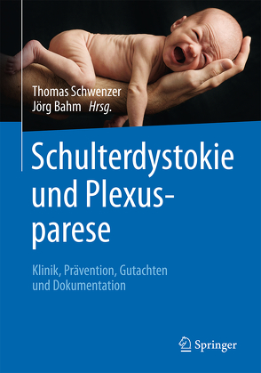 Schulterdystokie und Plexusparese von Bahm,  Jörg, Schwenzer,  Thomas
